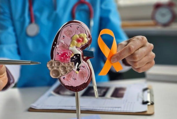 Cancer Treatment Centre